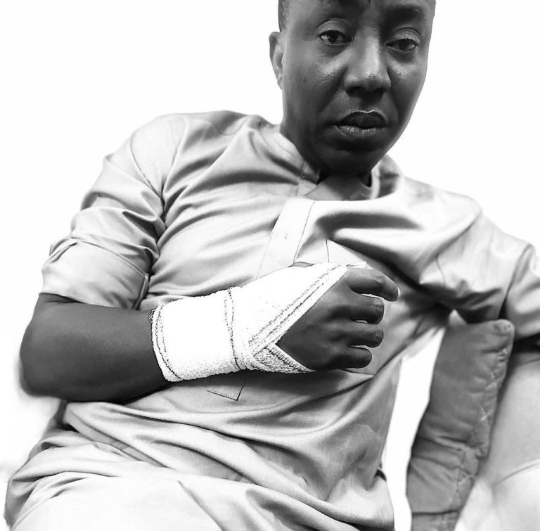 Omoyele Sowore Alleges Broken Arm After Police Assault in Detention